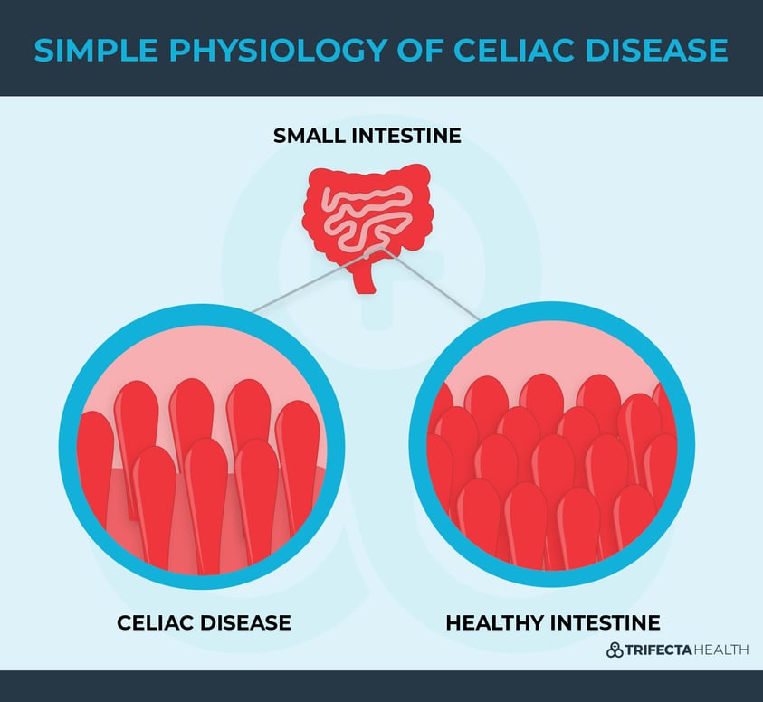 Diagrams_SIMPLE PHYSIOLOGY OF CELIAC DISEASE