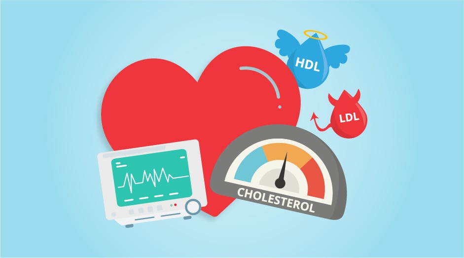 Headers_How to Lower Cholesterol (1)
